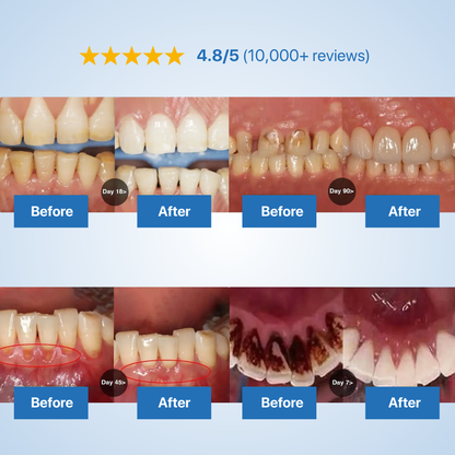 Reumi Tooth Repairing Powder